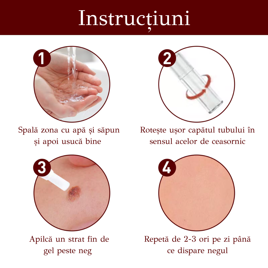 Gel Îndepărtare Negi