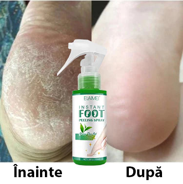 Spray Exfoliant pentru Bătături