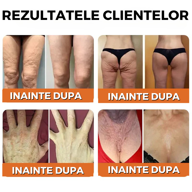 rezultate2