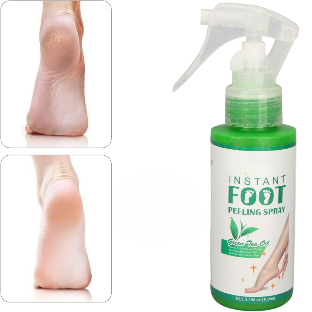 Spray Exfoliant pentru Bătături