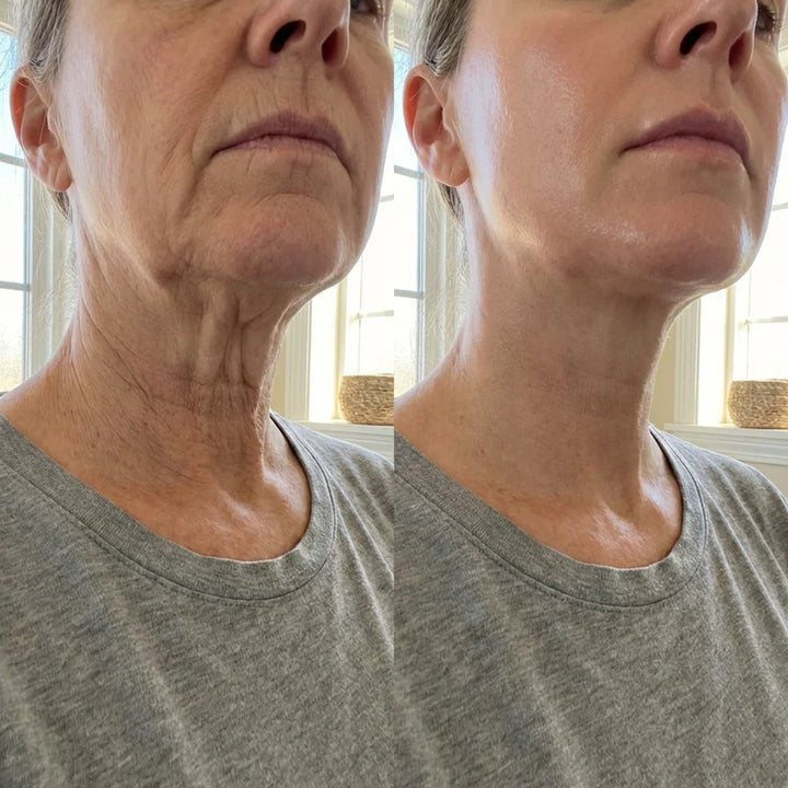 Fotografie comparativa a zonei gatului, inainte si dupa